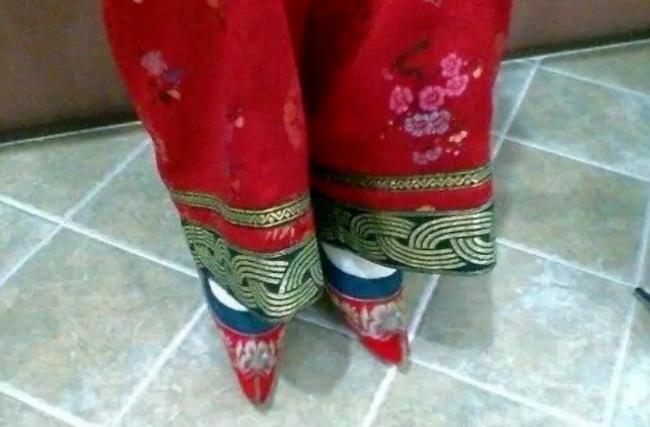 前方高能现代版缠足那些触目惊心的图片