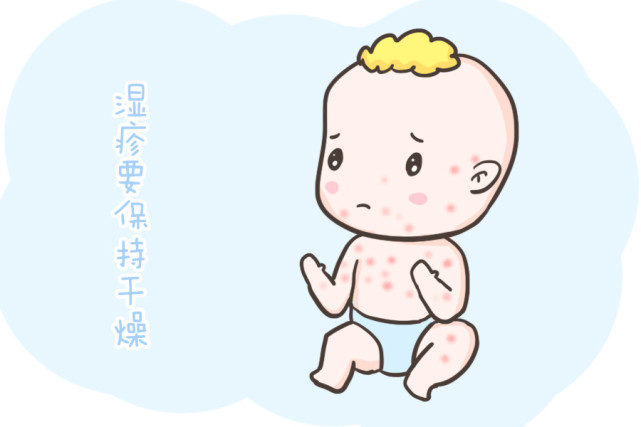 宝宝起痱子了不建议用痱子粉父母该如何护理