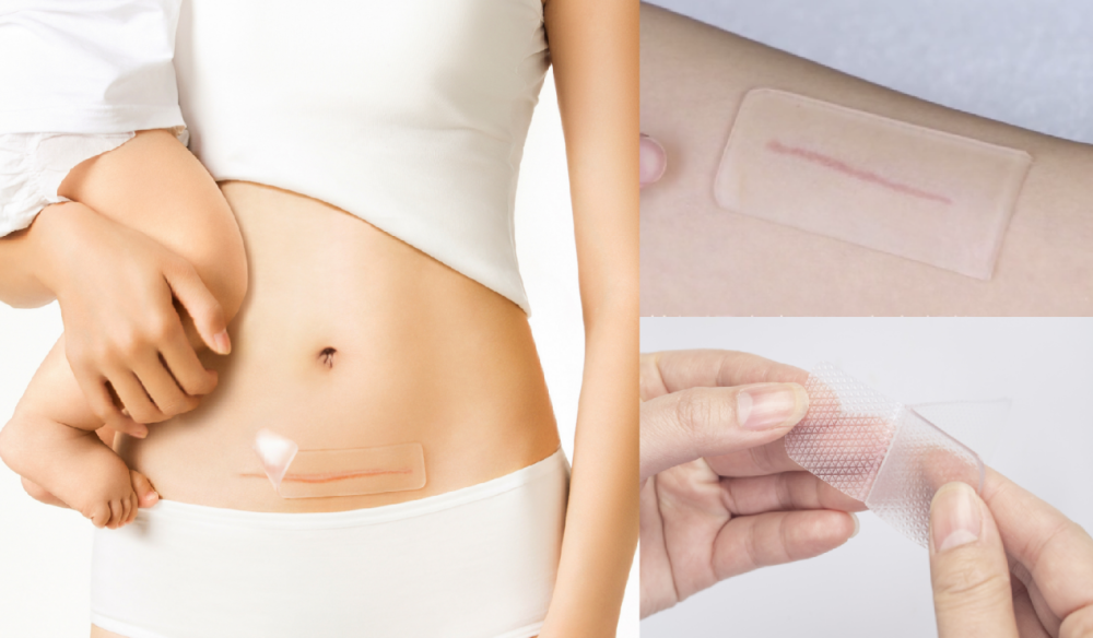 全球疫情创造行业风口，归领医疗国产超越进口