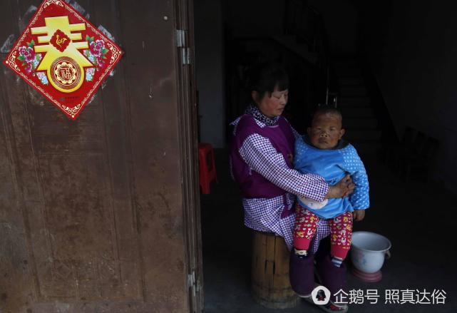 Chu Xiaoping merawat putranya, Wang