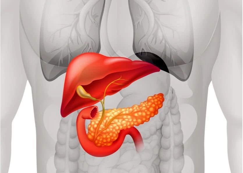 反覆出現這3種情況 或是胰腺癌徵兆