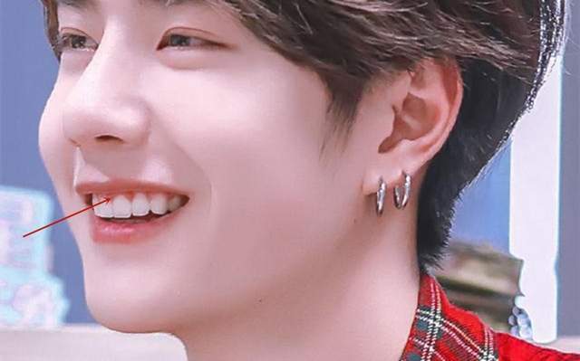 人体的好看与否,都是有迹可循的,你知道笑线吗?