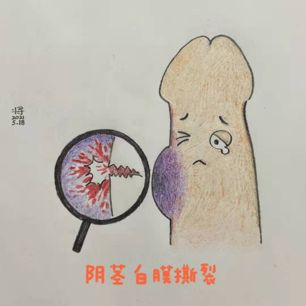 温州一对情侣太激动!下体"骨折"