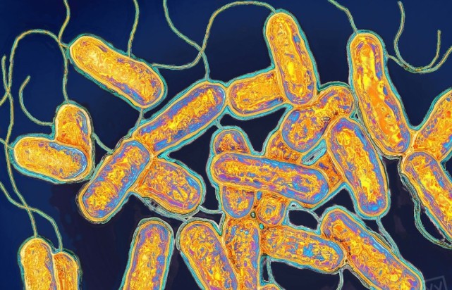 空调中滋生的病菌军团菌