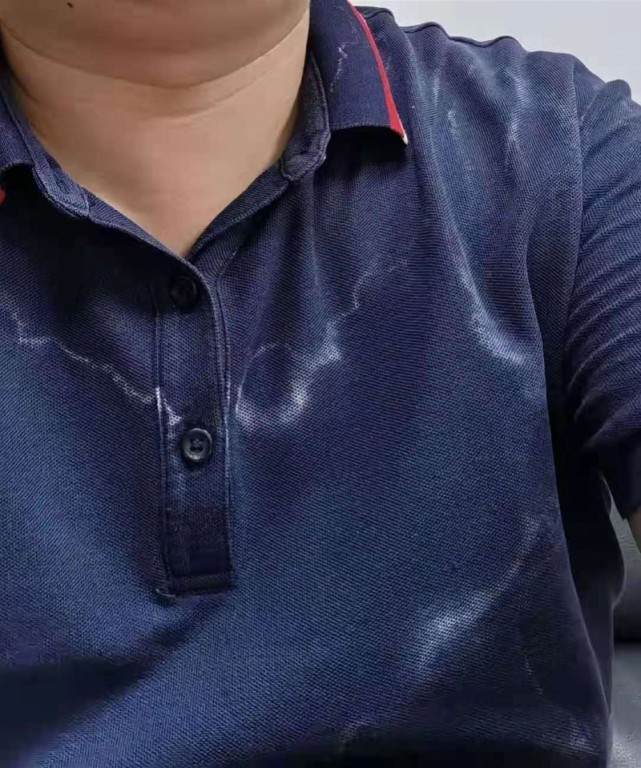 战疫者汗水反复湿透在衣服上析出一道道白色盐渍