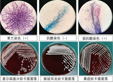 圖5奴卡菌及菌落形態奴卡菌不屬於人體正常菌群,主要引起外源性感染