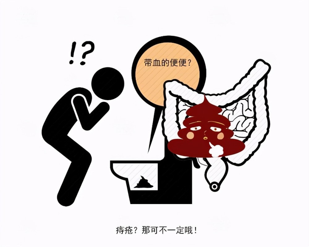 是痔疮还是肠癌提醒出现便血别大意还需要从3个细节来区分