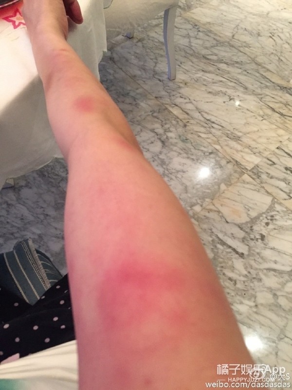 "因被家暴在谈离婚"的消息依然虽迟但到▽哪怕女方已经解释说是减肥