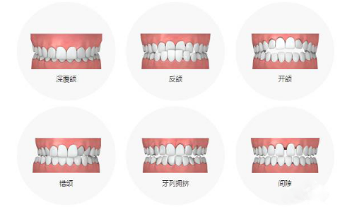 昌平牙齿齐不齐来看看整齐的牙齿咬合标准图国医康