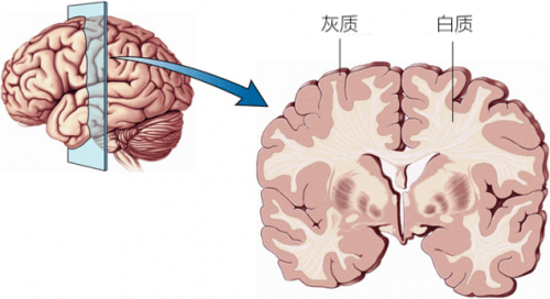 举个例子,你们实现脑-机之间的连接应该不需要做开颅质醢