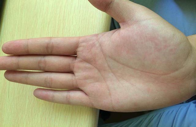 "金骨鱼"是什么?