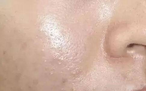 零死角洗净油光脏污|洗面奶|敏感肌肤|洁面|洁面膏|油皮|护肤