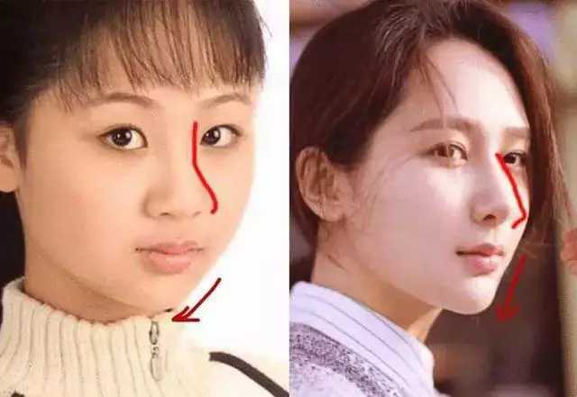 杨紫的脸又双叒叕翻车了?近距离无法直视,网友:人造硅胶既视感