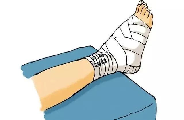 骨折术后的康复功能锻炼含上肢下肢