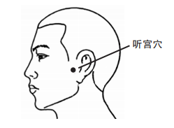 耳鸣久了会变聋吗医生听见这种声音赶快就医