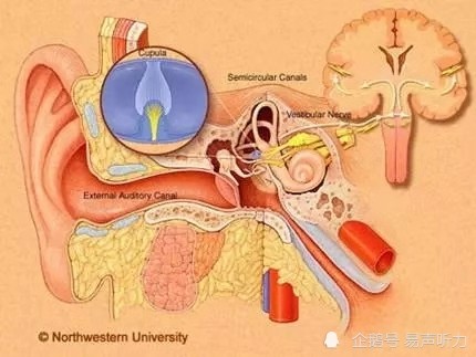 人工耳蜗与助听器有什么不同 腾讯新闻