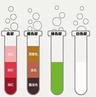五颜六色的尿透露健康的密码