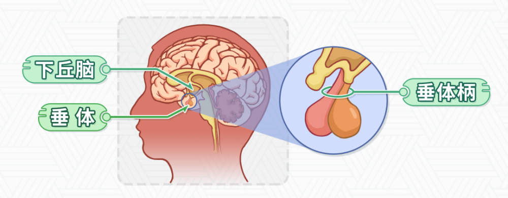 所以垂體柄相當於是連接下丘腦和垂體的橋樑,垂體柄中斷或者阻斷,下