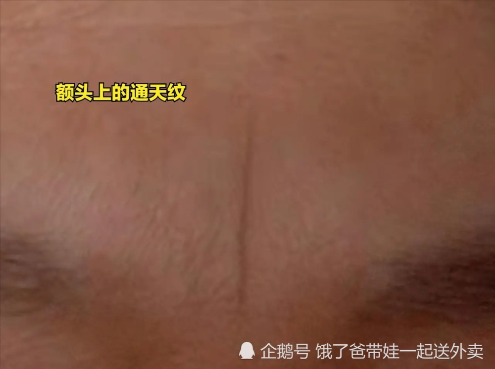 你有通天纹,我还有鱼尾纹,法令纹,抬头纹,我骄傲了