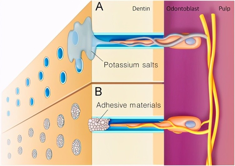碰冰牙齿就酸软无力?上亿国人都有的敏感性牙齿,究竟从哪里来?_腾讯新
