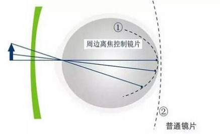 经常说周边离焦你知道什么是周边离焦嘛