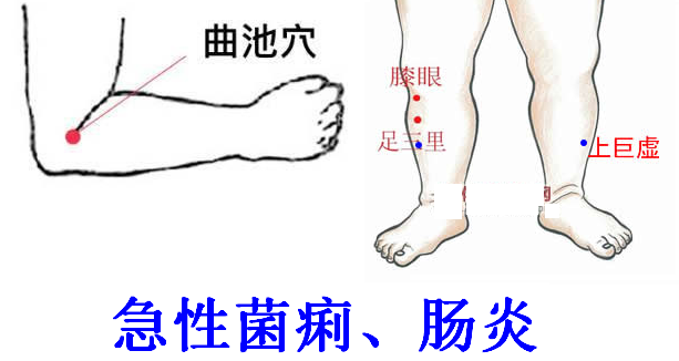 大柕穴 大椎 風池 後溪:用於頸