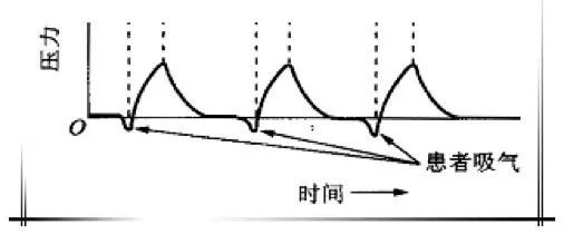 通气不足;而当患者呼吸很快时,呼吸机辅助呼吸频率也会增大,通气过度