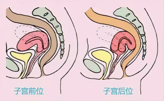 子宮前位比子宮後位更容易受孕備孕的夫妻要了解