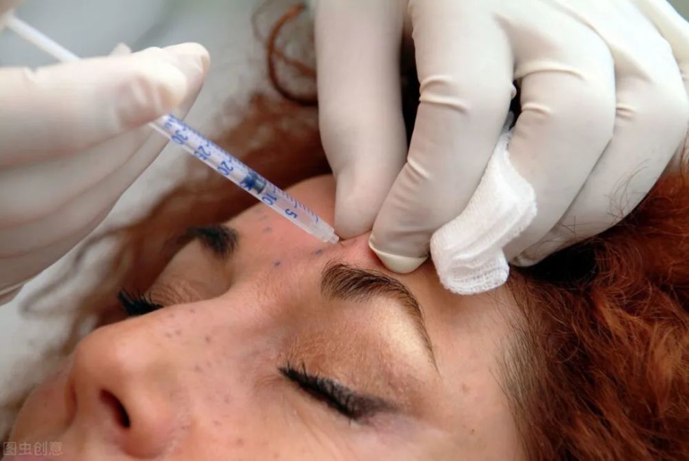 多久需要打一次除皱针_除皱针打一次需要多长时间