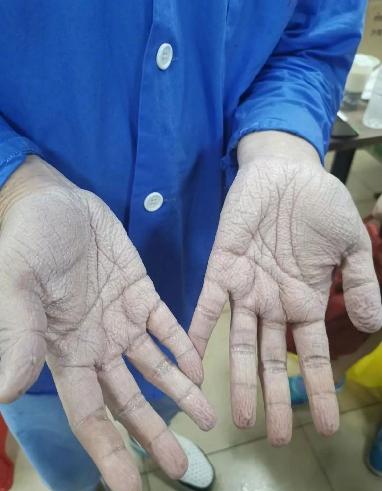 "毒王"再现,64岁南京老太引众怒:一个人,害了一座城!