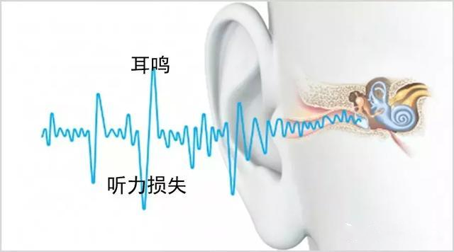 耳鸣人注意助听器能治耳鸣吗4大好处缓解耳鸣