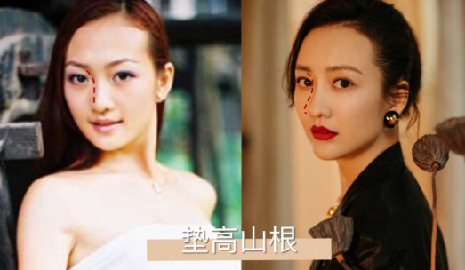 王鸥未整容旧照曝光,看清对比网友:能给个医生号码吗?_腾讯新闻