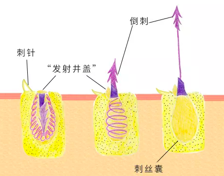 在碰到物体时,刺丝囊内的压力促使刺丝散开,刺细胞会如同飞镖一样弹出