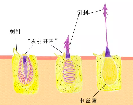 陳學冬被水母蜇傷有人說用尿液可以止痛