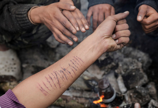 实拍波斯尼亚难民营,在死亡边缘挣扎的人们,缺乏食物和被褥