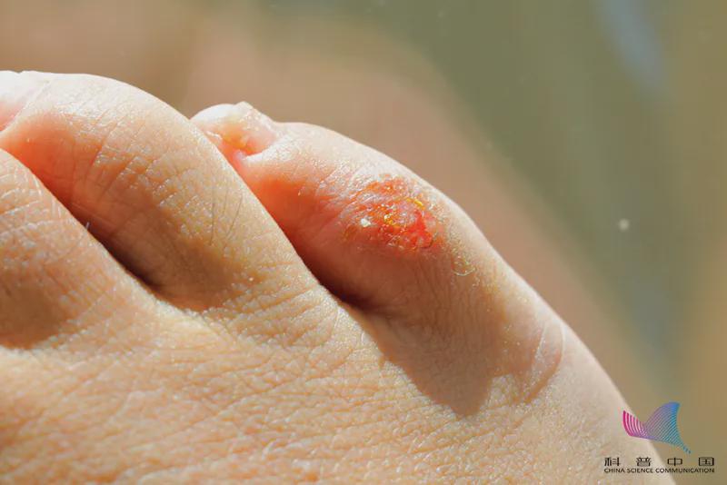 臭臭臭臭臭死了 为什么天天洗脚换袜子 脚还那么臭 你可能忽略了 全网搜