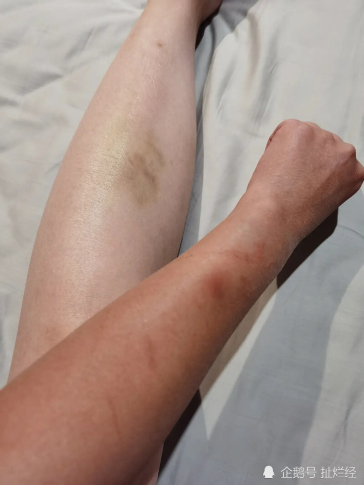 云南女游客因停车费被保安打伤,领头的疑似村保正,只赔了1千元