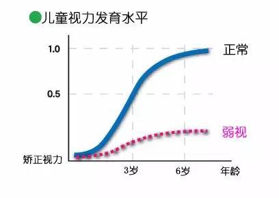 矫正视力 0 9 孩子可能是弱视 家长莫大意 腾讯新闻