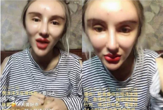 花费400多万整容200次的红粉宝宝现状如何与之前判若两人