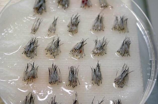 三 黑素细胞干细胞对毛发的影响毛囊突起和毛发胚芽区包含两个成体干