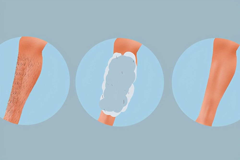 为什么欧美人体毛比国人多很多 体毛浓密 可以经常脱毛吗 腾讯新闻