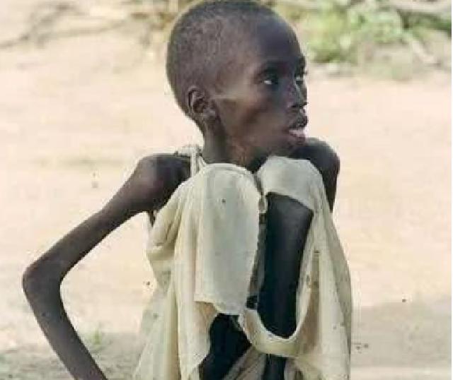 非洲小孩饥饿图片