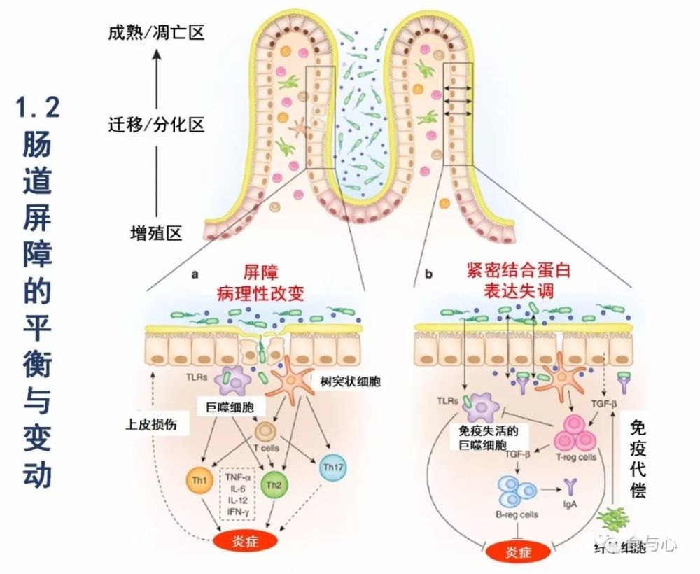 腸漏,你必須知道的熱知識13:腸漏的影響,原因和防治總結