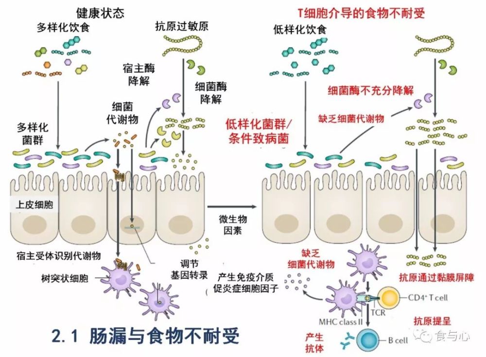 肠漏你必须知道的热知识13肠漏的影响原因和防治总结