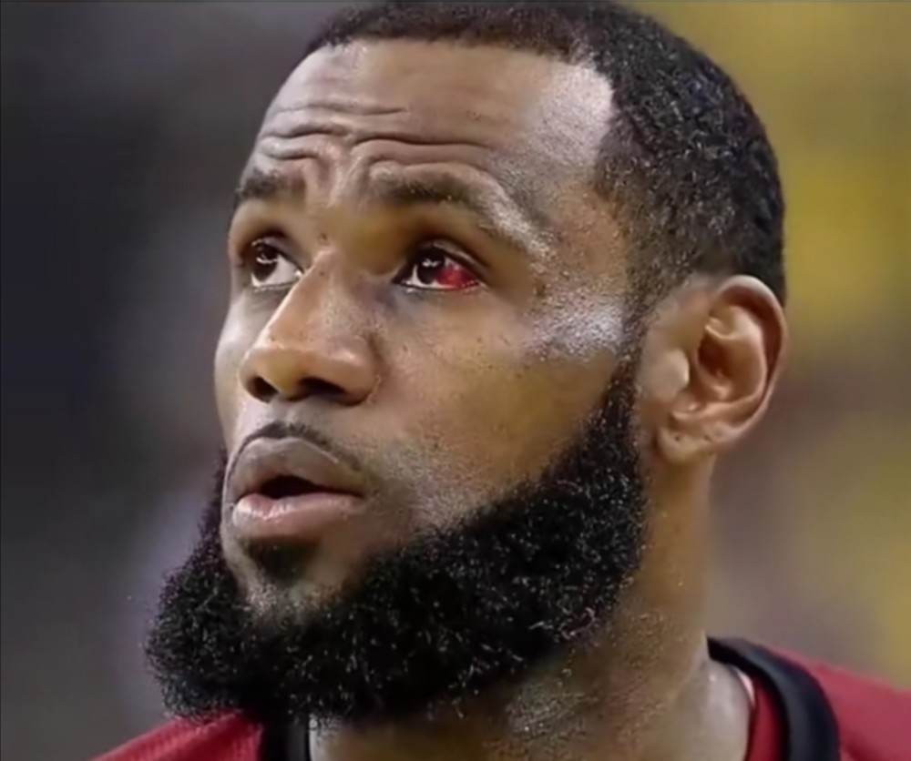 nba NBA流血瞬间