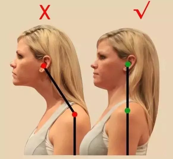 又好看,九特意准备了一些常见体态问题的纠正干货,一起做起来呀~ 探颈