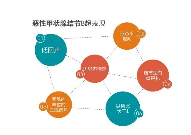 甲狀腺結節是甲狀腺內組織結構異常的團塊