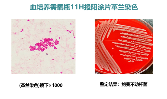 危急值怎麼跟臨床報?報什麼? 抗酸染色-有細菌形態 危急值報告 根據多