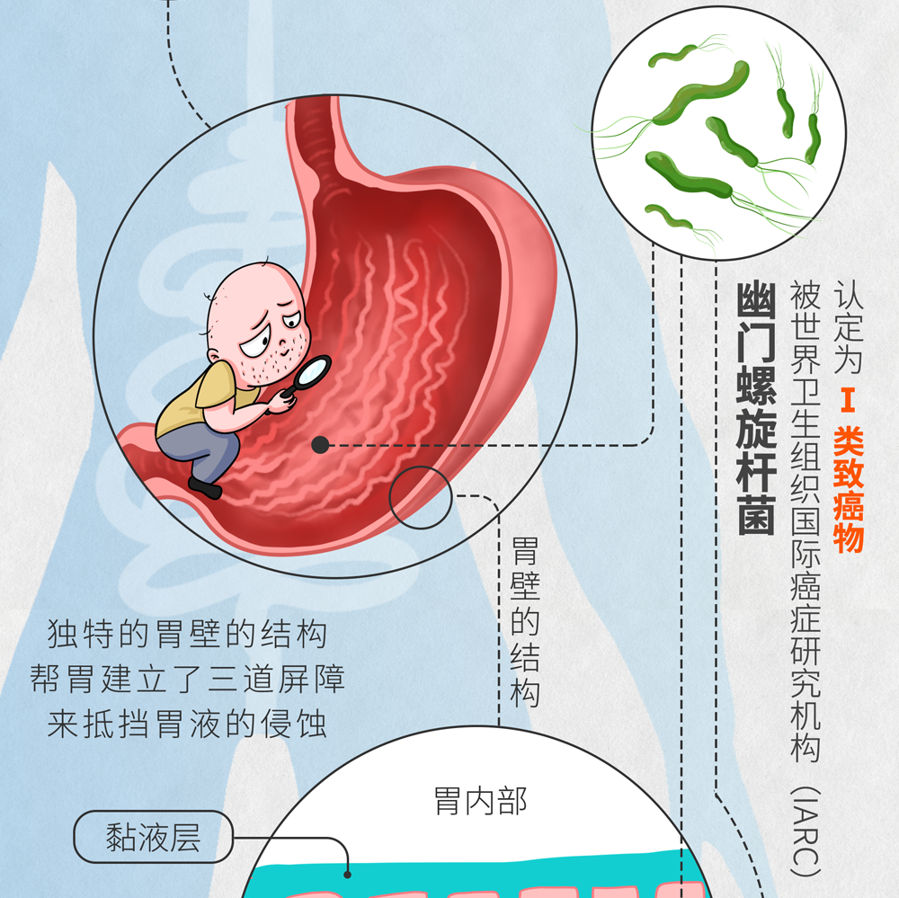 搞壞的可不只是你的胃,幽門螺旋桿菌究竟是個啥?