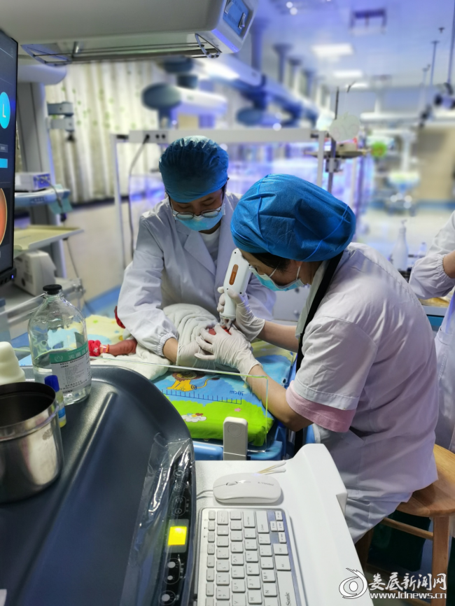 新化县人民医院在全县率先开展新生儿眼底筛查 为孩子光明未来把好第